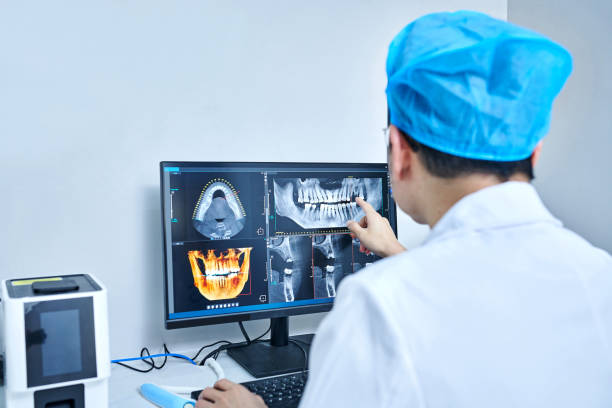 Best Emergency Tooth Extraction in Byron, MN